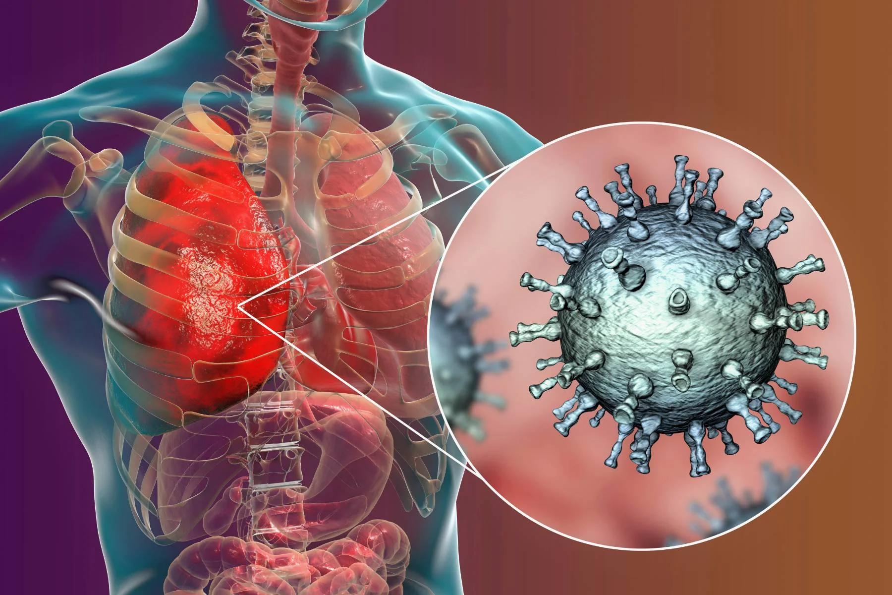 Legionella Risk Assessment For Landlords